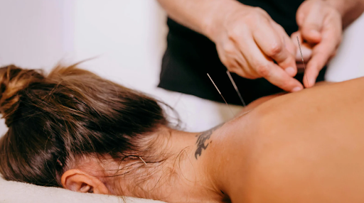 Functional Dry Needling
